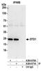 D-Aminoacyl-TRNA Deacylase 1 antibody, A304-670A, Bethyl Labs, Immunoprecipitation image 