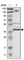 SUFU Negative Regulator Of Hedgehog Signaling antibody, HPA008700, Atlas Antibodies, Western Blot image 