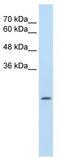 Delta-1-pyrroline-5-carboxylate dehydrogenase, mitochondrial antibody, TA338296, Origene, Western Blot image 