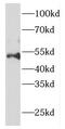 p50 dynamitin antibody, FNab02578, FineTest, Western Blot image 
