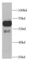 Pre-MRNA Processing Factor 19 antibody, FNab06813, FineTest, Western Blot image 