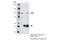 TPX2 Microtubule Nucleation Factor antibody, 12245S, Cell Signaling Technology, Immunoprecipitation image 