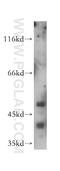 Histone-binding protein RBBP4 antibody, 14557-1-AP, Proteintech Group, Western Blot image 