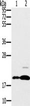 Protein Tyrosine Phosphatase 4A2 antibody, TA351555, Origene, Western Blot image 