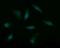 Musashi RNA Binding Protein 2 antibody, NBP2-45837, Novus Biologicals, Immunofluorescence image 