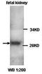 Chloride Intracellular Channel 1 antibody, orb76936, Biorbyt, Western Blot image 