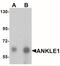 Ankyrin Repeat And LEM Domain Containing 1 antibody, NBP2-41144, Novus Biologicals, Western Blot image 