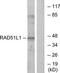 DNA repair protein RAD51 homolog 2 antibody, TA312603, Origene, Western Blot image 