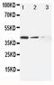 ATP Binding Cassette Subfamily C Member 4 antibody, PA1867, Boster Biological Technology, Western Blot image 