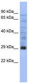 Proteasome Subunit Alpha 5 antibody, TA342162, Origene, Western Blot image 