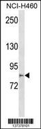 Multiple C2 And Transmembrane Domain Containing 2 antibody, 60-035, ProSci, Western Blot image 