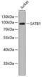 SATB Homeobox 1 antibody, 18-734, ProSci, Western Blot image 