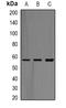 4-Aminobutyrate Aminotransferase antibody, LS-C482413, Lifespan Biosciences, Western Blot image 