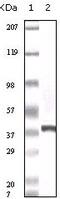 S100 Calcium Binding Protein A6 antibody, 32-124, ProSci, Enzyme Linked Immunosorbent Assay image 