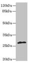 Enoyl-[acyl-carrier-protein] reductase [NADPH] FabI antibody, MBS7001323, MyBioSource, Western Blot image 