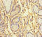 Ankyrin Repeat Domain 33 antibody, LS-C398876, Lifespan Biosciences, Immunohistochemistry paraffin image 