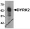 Dual specificity tyrosine-phosphorylation-regulated kinase 2 antibody, 6257, ProSci Inc, Western Blot image 