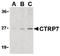 C1q And TNF Related 7 antibody, LS-B469, Lifespan Biosciences, Western Blot image 