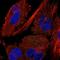 Myotubularin Related Protein 11 antibody, NBP1-90620, Novus Biologicals, Immunofluorescence image 