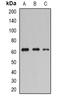 Plasminogen Activator, Tissue Type antibody, orb381959, Biorbyt, Western Blot image 
