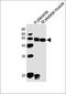 CD3 antibody, orb1175, Biorbyt, Western Blot image 