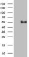 Beta-1,4-Galactosyltransferase 3 antibody, NBP2-46561, Novus Biologicals, Western Blot image 