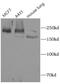 WRN RecQ Like Helicase antibody, FNab09524, FineTest, Western Blot image 