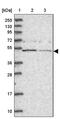 Glucose-Fructose Oxidoreductase Domain Containing 2 antibody, PA5-59431, Invitrogen Antibodies, Western Blot image 