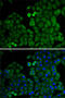 E2F Transcription Factor 6 antibody, 22-034, ProSci, Immunofluorescence image 