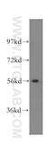 SET And MYND Domain Containing 1 antibody, 16151-1-AP, Proteintech Group, Western Blot image 