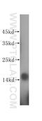Prefoldin Subunit 4 antibody, 16045-1-AP, Proteintech Group, Western Blot image 