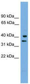 Proline Rich Nuclear Receptor Coactivator 1 antibody, TA340140, Origene, Western Blot image 