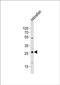 Basic Helix-Loop-Helix Family Member A9 antibody, PA5-72673, Invitrogen Antibodies, Western Blot image 