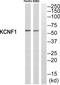 Potassium Voltage-Gated Channel Modifier Subfamily F Member 1 antibody, PA5-39351, Invitrogen Antibodies, Western Blot image 