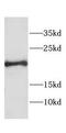 Centrin 1 antibody, FNab01592, FineTest, Western Blot image 