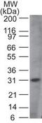 MYD88 Innate Immune Signal Transduction Adaptor antibody, TA337031, Origene, Western Blot image 