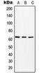 Monocarboxylate transporter 8 antibody, orb214586, Biorbyt, Western Blot image 