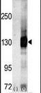 Calcium/Calmodulin Dependent Serine Protein Kinase antibody, PA5-14040, Invitrogen Antibodies, Western Blot image 