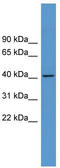 Adenosine A1 Receptor antibody, TA342790, Origene, Western Blot image 