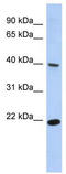 Single Stranded DNA Binding Protein 4 antibody, TA341418, Origene, Western Blot image 