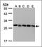 GDP Dissociation Inhibitor 2 antibody, AP23171PU-N, Origene, Western Blot image 