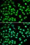 Cyclin Dependent Kinase Inhibitor 2D antibody, LS-C346115, Lifespan Biosciences, Immunofluorescence image 