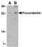 Cerebellin 1 Precursor antibody, TA306244, Origene, Western Blot image 