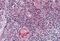 Wnt Family Member 5B antibody, orb89035, Biorbyt, Immunohistochemistry paraffin image 