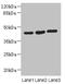 MAPK Activated Protein Kinase 3 antibody, LS-C676019, Lifespan Biosciences, Western Blot image 