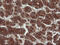 NADPH Dependent Diflavin Oxidoreductase 1 antibody, M09352, Boster Biological Technology, Immunohistochemistry paraffin image 