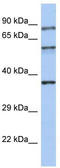 Rabphilin 3A antibody, TA330011, Origene, Western Blot image 