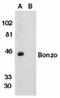 C-X-C Motif Chemokine Receptor 6 antibody, ADI-905-276-100, Enzo Life Sciences, Western Blot image 