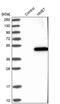NME/NM23 Family Member 7 antibody, PA5-58210, Invitrogen Antibodies, Western Blot image 