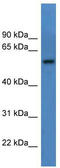 Carnosine Dipeptidase 1 antibody, TA343002, Origene, Western Blot image 